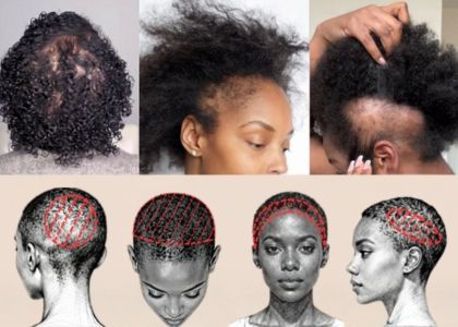 How to choose a wig for thin hair