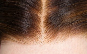 Pre-bleached knots close-up